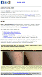Mobile Screenshot of acne.net